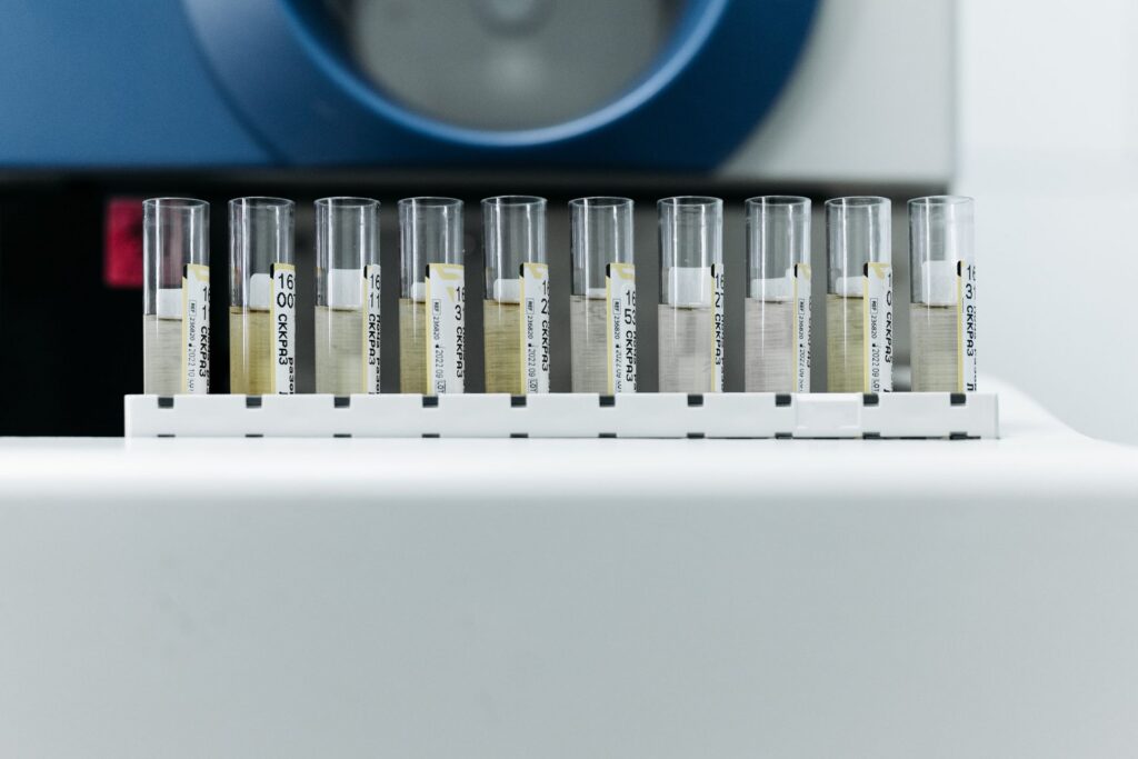 Row of sample tubes in a lab rack, as used for emulsion stability testing